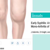 Arthritic Knee Syphilis